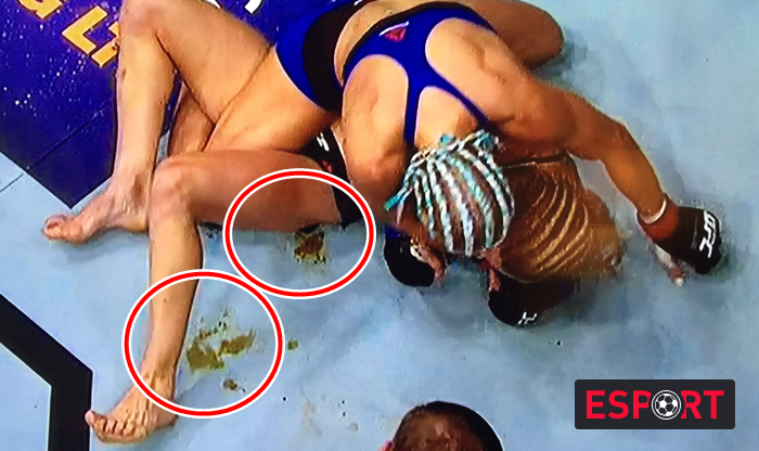 ყველაზე უცნაური შემთხვევა - რა დაემართა UFC-ს მებრძოლ გოგონას ოქტაგონზე (ვიდეო)